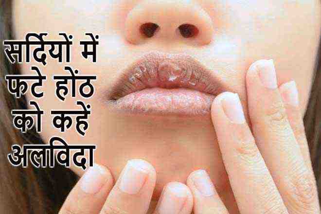 Home Remedies How to get rid of Chapped Lips