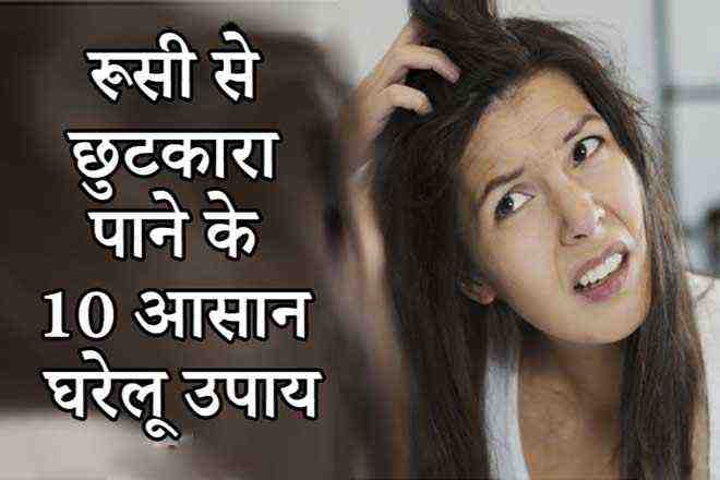 Home Remedies To Get Rid Of Dandruff