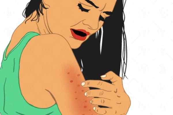 skin allergy reason medicine home remedies to get rid of skin allergy